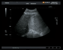 Kontrastmittel erlaubt erstaunliche Diagnosen